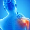 Course:  Yoga Therapy for the Rotator Cuff with Justine Shelton and Monique Lonner - 8.0 Hrs